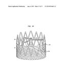 COLLAPSIBLE AND RE-EXPANDABLE PROSTHETIC HEART VALVE CUFF DESIGNS AND     COMPLEMENTARY TECHNOLOGICAL APPLICATIONS diagram and image