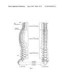 SELECTIVELY EXPANDING SPINE CAGE WITH ENHANCED BONE GRAFT INFUSION diagram and image