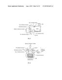 SELECTIVELY EXPANDING SPINE CAGE WITH ENHANCED BONE GRAFT INFUSION diagram and image