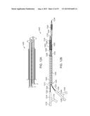 System and Methods for Treating a Bifurcation diagram and image