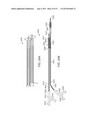 System and Methods for Treating a Bifurcation diagram and image