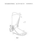 ANKLE FLEXIBLE SUPPORT SYSTEM diagram and image