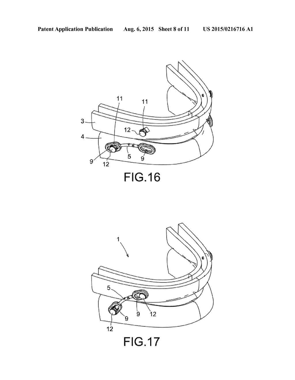 MANDIBULAR ADVANCEMENT DEVICE, AND A METHOD AND KIT FOR PREPARING SAID     DEVICE - diagram, schematic, and image 09