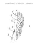 BESPOKE WOUND TREATMENT APPARATUSES AND METHODS FOR USE IN NEGATIVE     PRESSURE WOUND THERAPY diagram and image