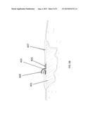 BESPOKE WOUND TREATMENT APPARATUSES AND METHODS FOR USE IN NEGATIVE     PRESSURE WOUND THERAPY diagram and image