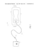 WOUND DRESSING AND METHOD OF TREATMENT diagram and image