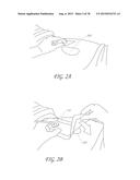 WOUND DRESSING AND METHOD OF TREATMENT diagram and image
