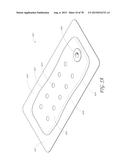 WOUND DRESSING AND METHOD OF TREATMENT diagram and image