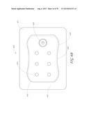 WOUND DRESSING AND METHOD OF TREATMENT diagram and image