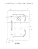 WOUND DRESSING AND METHOD OF TREATMENT diagram and image