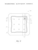 WOUND DRESSING AND METHOD OF TREATMENT diagram and image