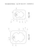 WOUND DRESSING AND METHOD OF TREATMENT diagram and image