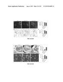 EXOSOME-BASED THERAPEUTICS AGAINST NEURODEGENERATIVE DISORDERS diagram and image