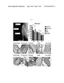GALECTIN-3 INHIBITOR (GAL-3M) IS ASSOCIATED WITH ADDITIVE ANTI-MYELOMA AND     ANTI-SOLID TUMOR EFFECTS, DECREASED OSTEOCLASTOGENESIS AND ORGAN     PROTECTION WHEN USED IN COMBINATION WITH PROTEASOME INHIBITORS diagram and image