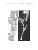 SELF-HARDENING BIOACTIVE CEMENT COMPOSITIONS WITH PARTIALLY DEACETYLATED     CHITIN AS BONE GRAFT SUBSTITUTES diagram and image