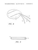 Extracellular Matrix Encasement Structures and Methods diagram and image