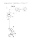 Fluid Isolator for Breast Pump Systems diagram and image