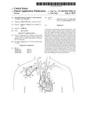 METHOD OF DELIVERING A TRANSSEPTAL CANNULA TO A HEART diagram and image