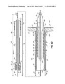 METHOD OF DELIVERING A TRANSSEPTAL CANNULA TO A HEART diagram and image