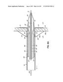 METHOD OF DELIVERING A TRANSSEPTAL CANNULA TO A HEART diagram and image