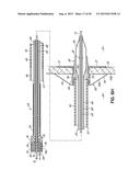 METHOD OF DELIVERING A TRANSSEPTAL CANNULA TO A HEART diagram and image