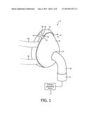 LEAK CORRECTION FOR A PATIENT INTERFACE DEVICE diagram and image