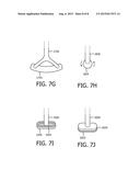 LEAK CORRECTION FOR A PATIENT INTERFACE DEVICE diagram and image