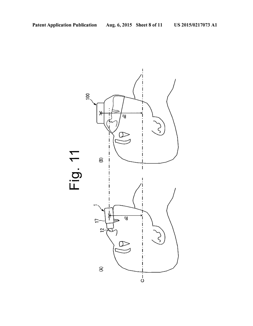 RESPIRATORY ASSISTANCE DEVICE - diagram, schematic, and image 09