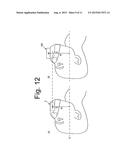 RESPIRATORY ASSISTANCE DEVICE diagram and image