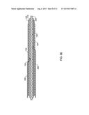 CRESCENT CHANNEL DYE FLOW ENABLED GUIDE CATHETERS diagram and image