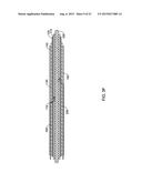 CRESCENT CHANNEL DYE FLOW ENABLED GUIDE CATHETERS diagram and image