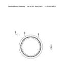 CRESCENT CHANNEL DYE FLOW ENABLED GUIDE CATHETERS diagram and image