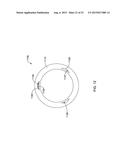 CRESCENT CHANNEL DYE FLOW ENABLED GUIDE CATHETERS diagram and image