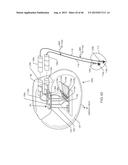 RF FILTER FOR AN ACTIVE MEDICAL DEVICE (AMD) FOR HANDLING HIGH RF POWER     INDUCED IN AN ASSOCIATED IMPLANTED LEAD FROM AN EXTERNAL RF FIELD diagram and image