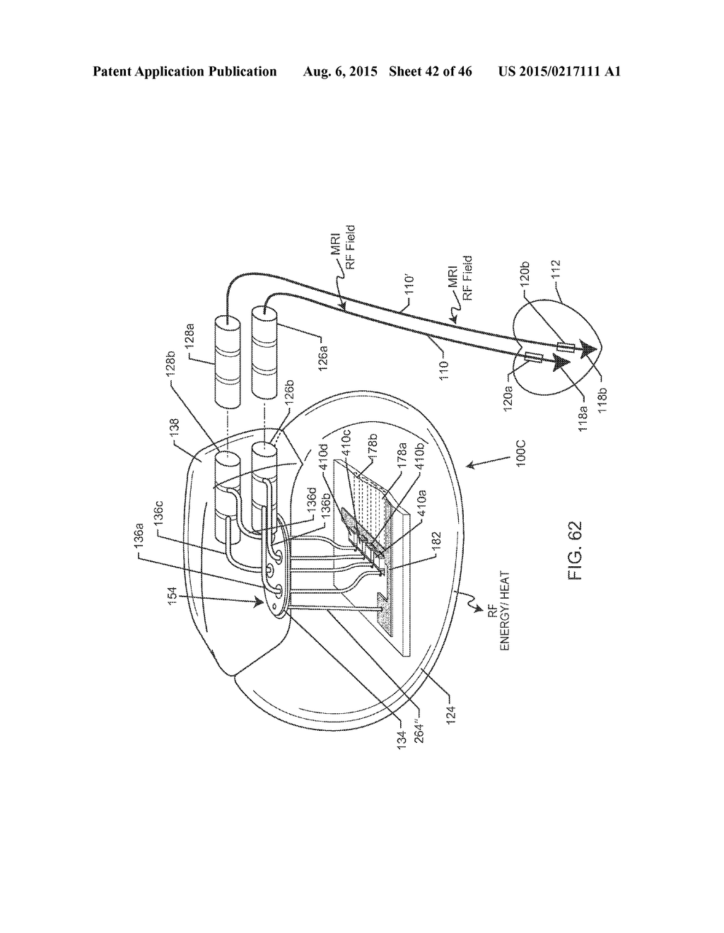 RF FILTER FOR AN ACTIVE MEDICAL DEVICE (AMD) FOR HANDLING HIGH RF POWER     INDUCED IN AN ASSOCIATED IMPLANTED LEAD FROM AN EXTERNAL RF FIELD - diagram, schematic, and image 43