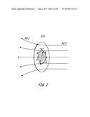 THERMALLY ASSISTED PULSED ELECTRO-MAGNETIC FIELD STIMULATION DEVICE AND     METHOD FOR TREATMENT OF OSTEOARTHRITIS diagram and image