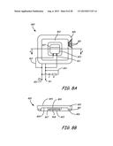 THERMALLY ASSISTED PULSED ELECTRO-MAGNETIC FIELD STIMULATION DEVICE AND     METHOD FOR TREATMENT OF OSTEOARTHRITIS diagram and image