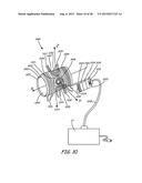 THERMALLY ASSISTED PULSED ELECTRO-MAGNETIC FIELD STIMULATION DEVICE AND     METHOD FOR TREATMENT OF OSTEOARTHRITIS diagram and image