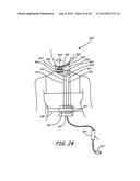 THERMALLY ASSISTED PULSED ELECTRO-MAGNETIC FIELD STIMULATION DEVICE AND     METHOD FOR TREATMENT OF OSTEOARTHRITIS diagram and image