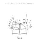 THERMALLY ASSISTED PULSED ELECTRO-MAGNETIC FIELD STIMULATION DEVICE AND     METHOD FOR TREATMENT OF OSTEOARTHRITIS diagram and image