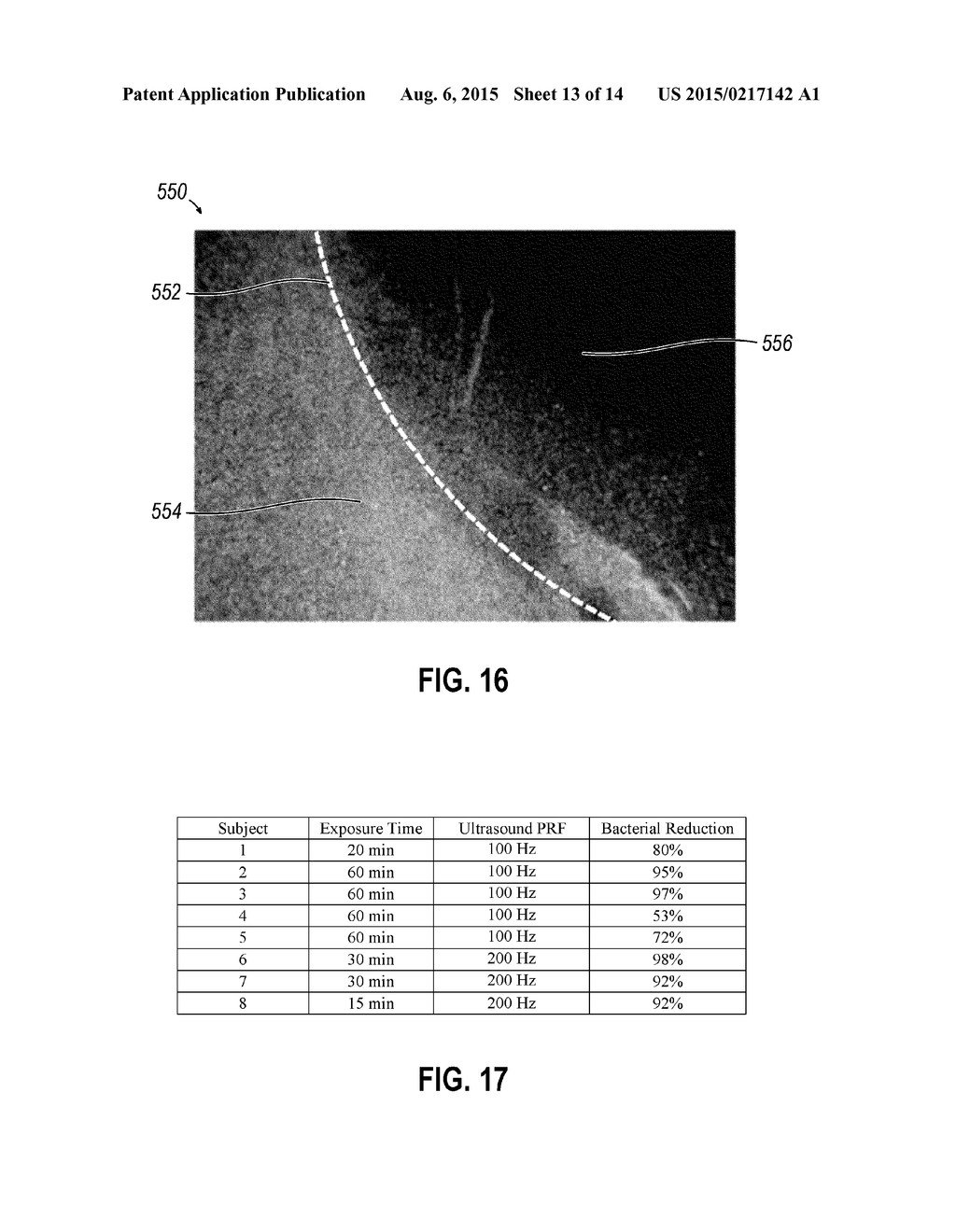 METHOD AND DEVICE FOR TREATMENT WITH COMBINATION ULTRASOUND-PHOTOTHERAPY     TRANSDUCER - diagram, schematic, and image 14