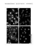 Methods and Peptides for Preventing and Treating A BCR-ABL and a C-ABL     Associated Disease diagram and image