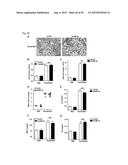 SHORT-FORM HUMAN MD-2 AS A NEGATIVE REGULATOR OF TOLL-LIKE RECEPTOR 4     SIGNALING diagram and image
