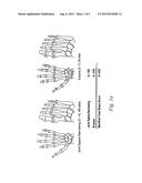 Use of TNFalpha Inhibitor for Treatment of Psoriasis diagram and image