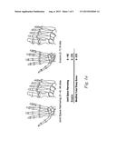 USE OF TNFALPHA INHIBITOR FOR TREATMENT OF PSORIATIC ARTHRITIS diagram and image