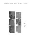 COMPOSITIONS AND METHODS FOR DIAGNOSING AND TREATING AN INFLAMMATION diagram and image