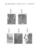 COMPOSITIONS AND METHODS FOR DIAGNOSING AND TREATING AN INFLAMMATION diagram and image