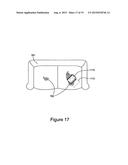 Methods and Apparatus for Laser Cleaning of Fabric Materials diagram and image