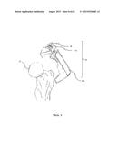 SYSTEM AND METHOD FOR REGISTRATION IN ORTHOPAEDIC APPLICATIONS diagram and image