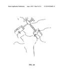 SYSTEM AND METHOD FOR REGISTRATION IN ORTHOPAEDIC APPLICATIONS diagram and image